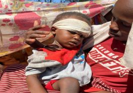 A child whose family fled violence perpetrated by the Rapid Support Forces in El Fasher receives treatment at a displacement camp.