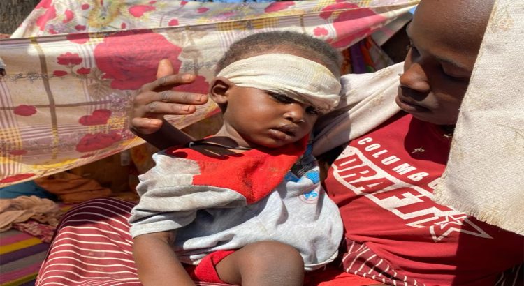 A child whose family fled violence perpetrated by the Rapid Support Forces in El Fasher receives treatment at a displacement camp.
